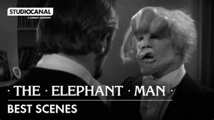 Is there a real elephant man