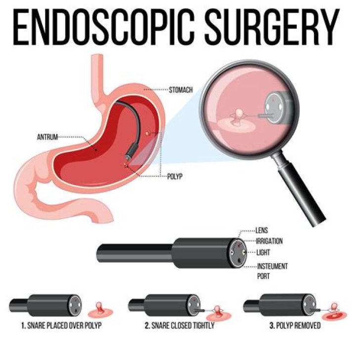 Is TIPS procedure reversible