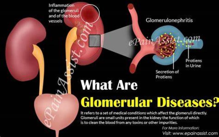 What are glomerular diseases
