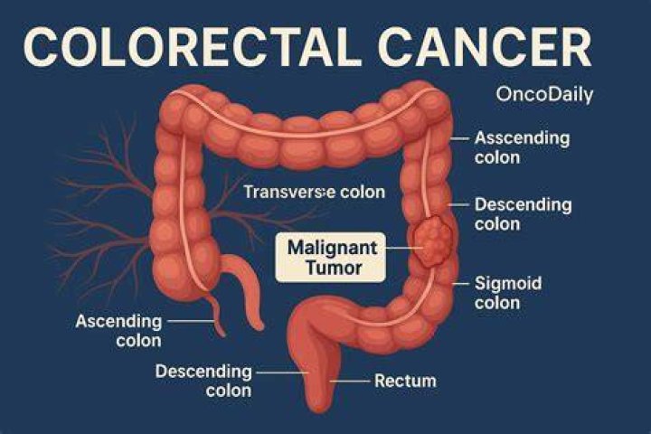 What are rectal exams called