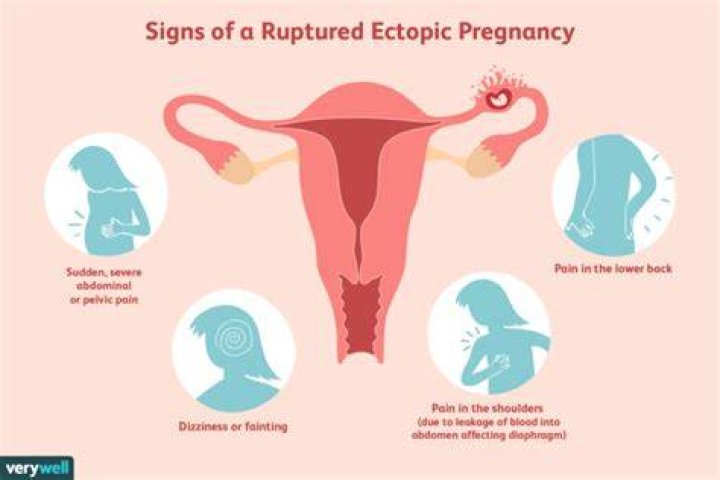 What causes ectopic eruption