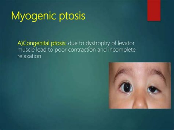 What causes myogenic ptosis
