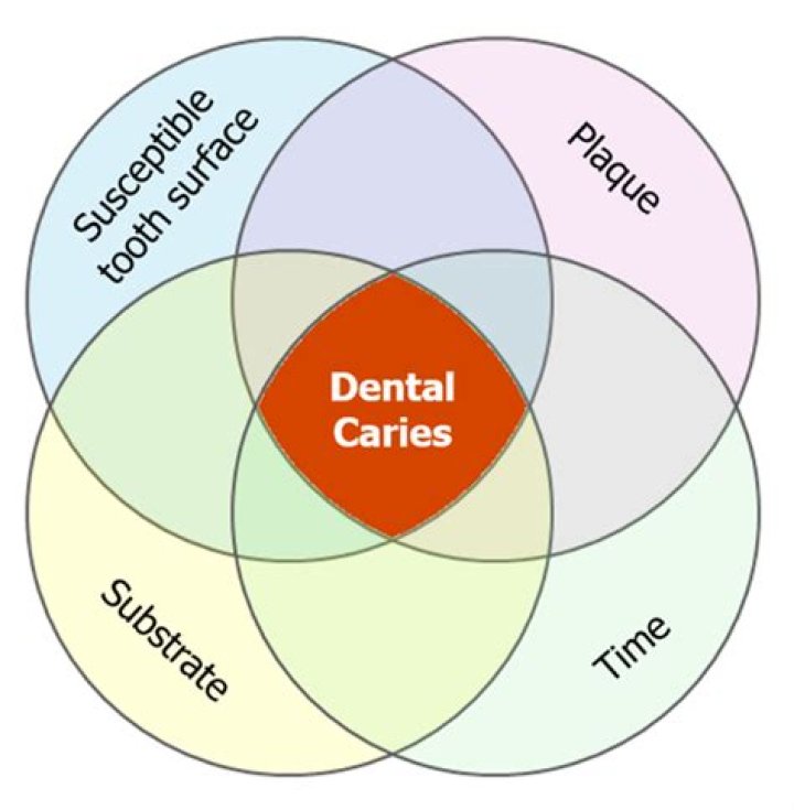 What causes recurrent caries