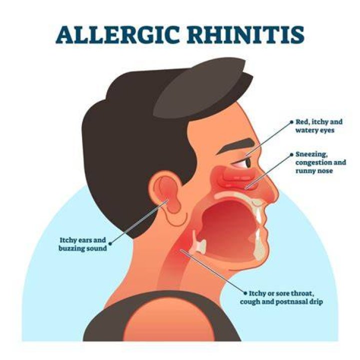 What causes Rhinopharyngitis