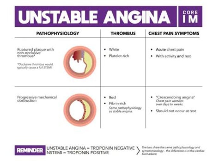 What causes unstable angina