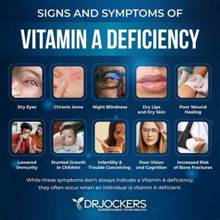 What causes Vit A deficiency