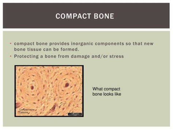 What compact bone looks like