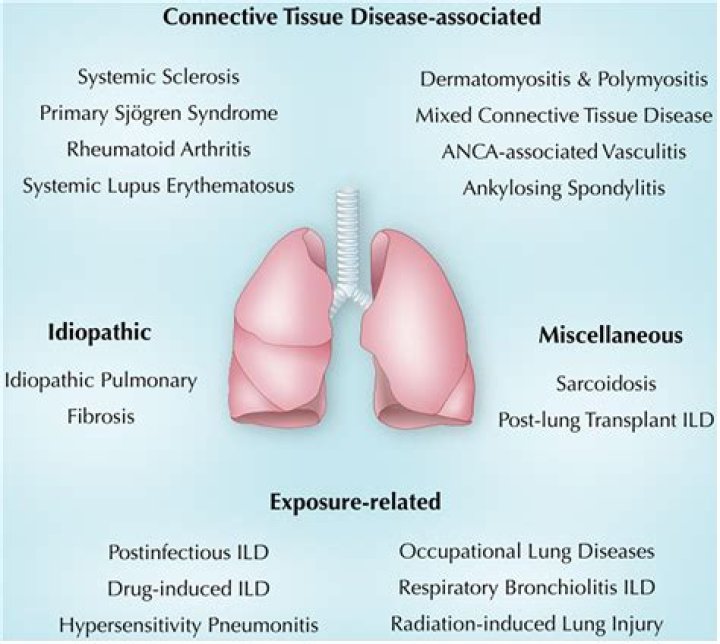What diseases cause crepitus
