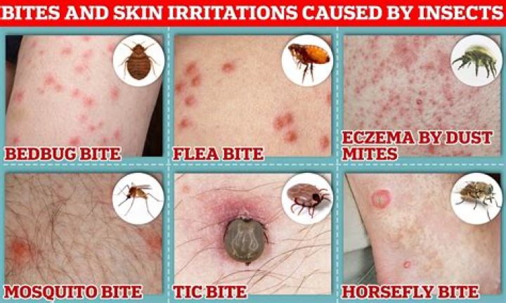 What do bugs inject you with