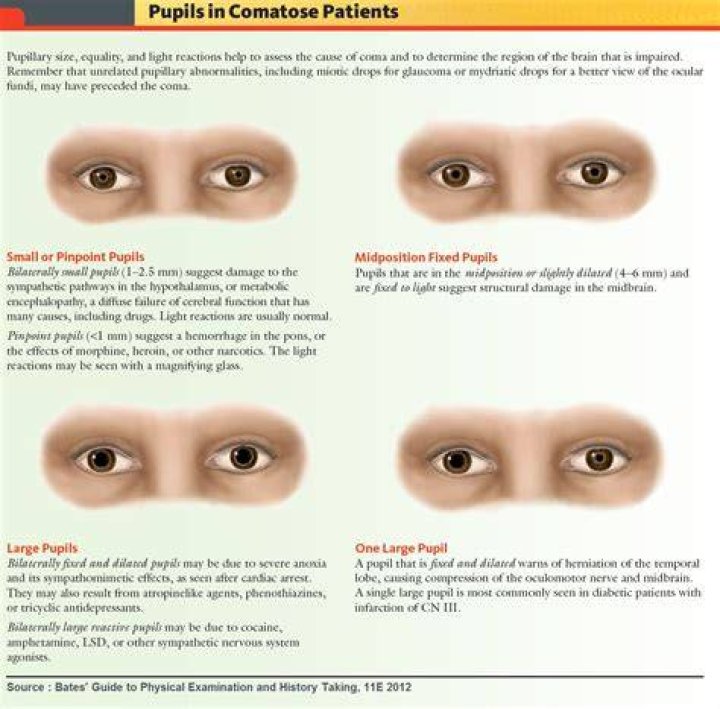 What does a white pupil mean