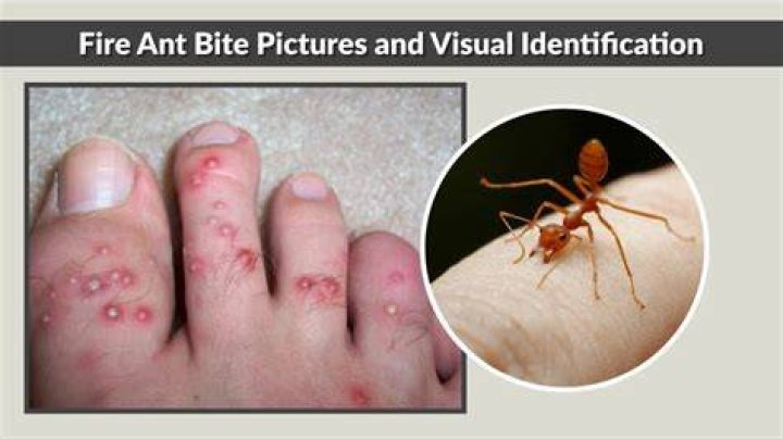What does ant bite look like