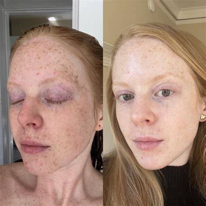 What does Aveda exfoliant do