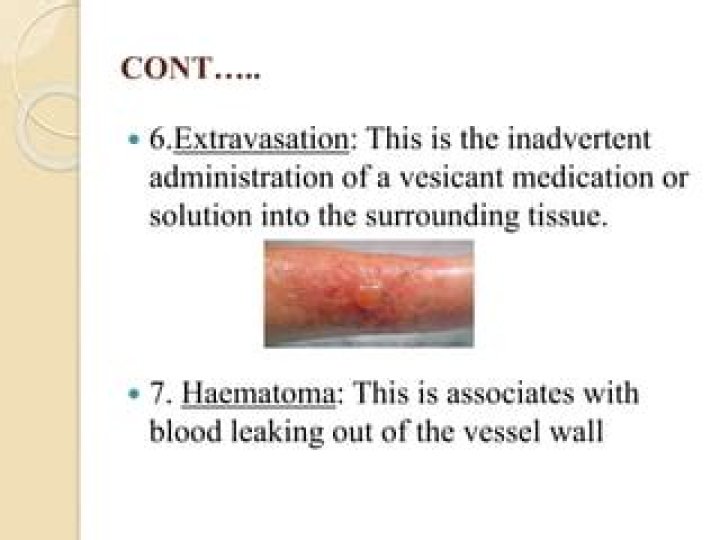 What does extravasation mean