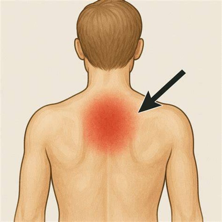 What does Interscapular mean