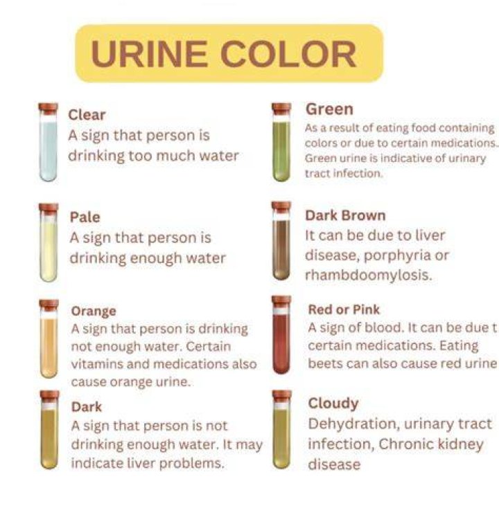 What does MSU in urine mean