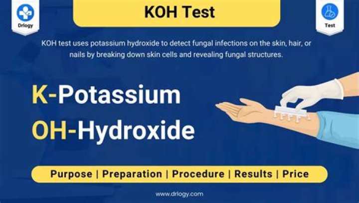 What does potassium hydroxide do to your skin