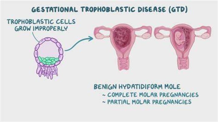 What does trophoblastic mean