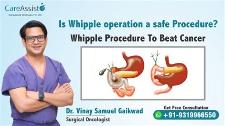 What does Whipple stand for
