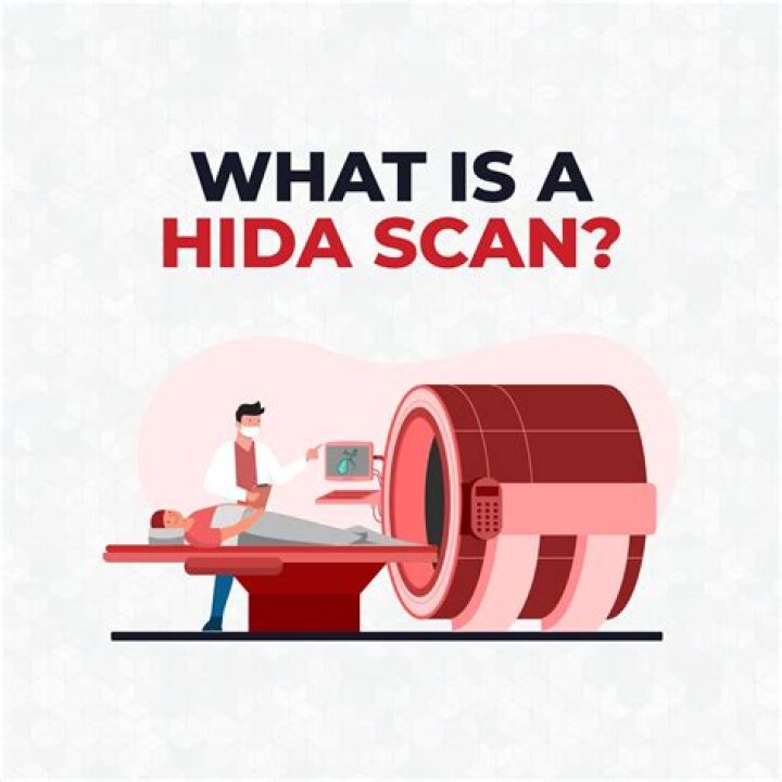 What is a HIDA scan looking for