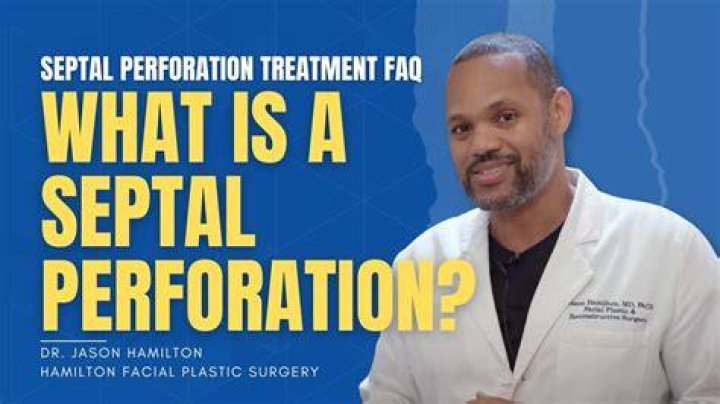 What is a septal perforation