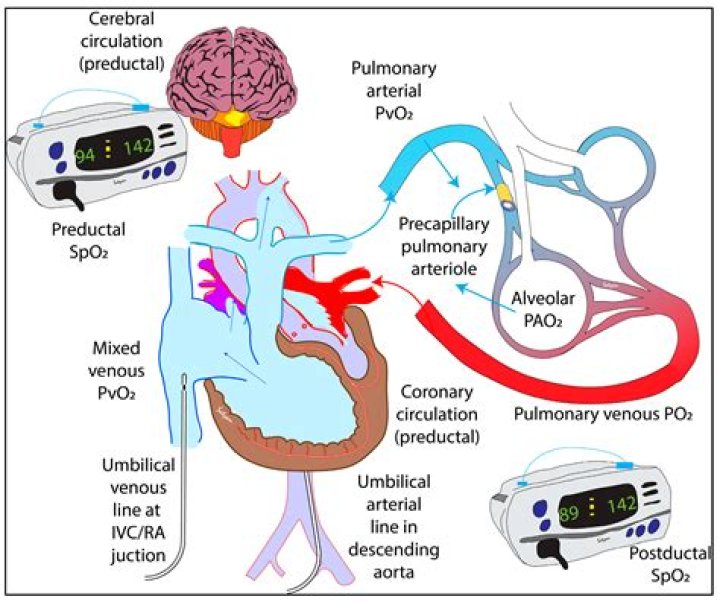 What is arterial oxygenation