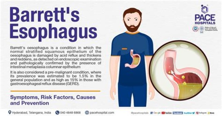 What is Bartletts esophagus
