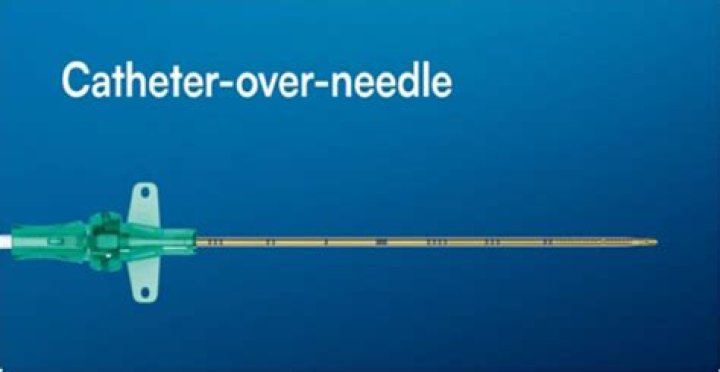 What is catheter over needle