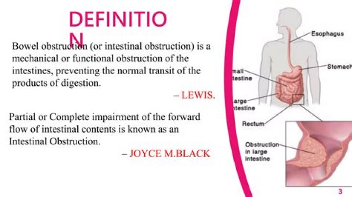 What is complete obstruction