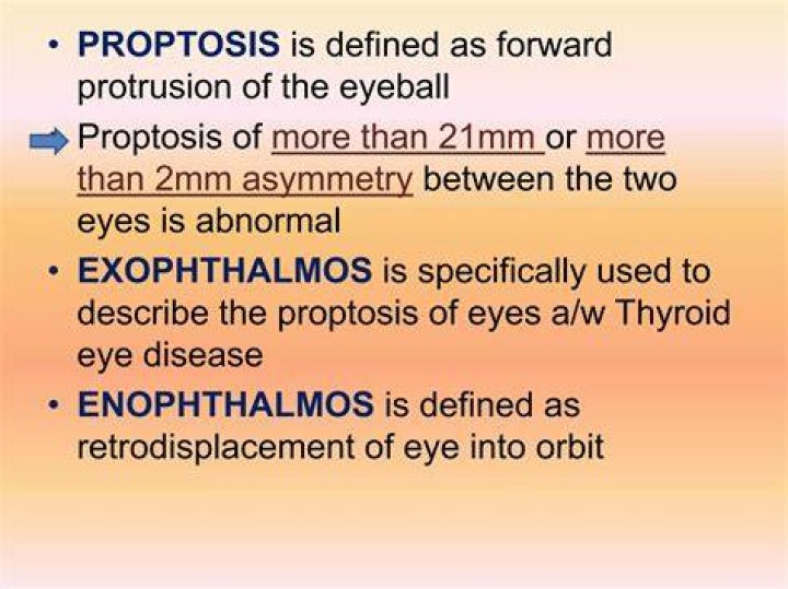 What is considered proptosis