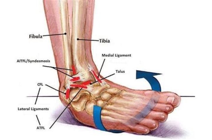 What is lateral foot support