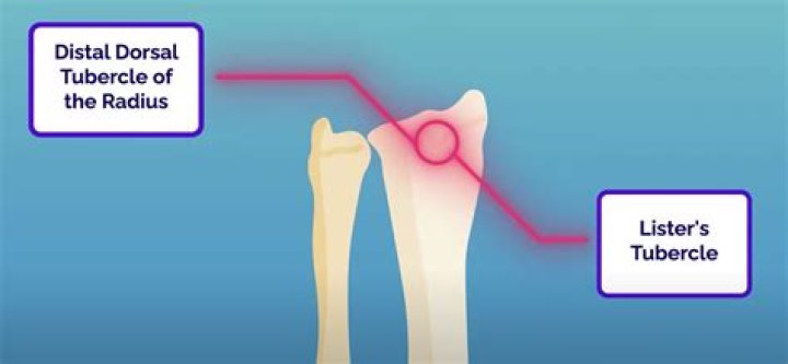 What is Listers tubercle