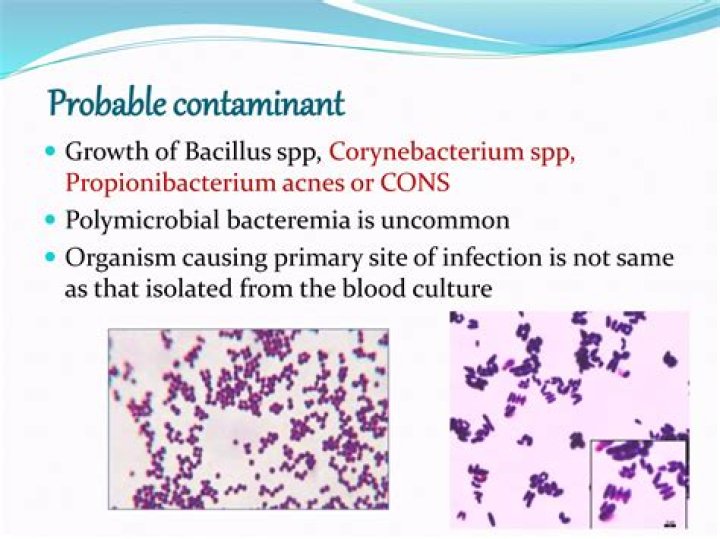 What is Polymicrobial growth
