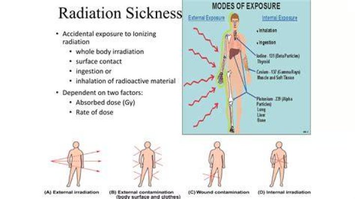What is radioactive sickness