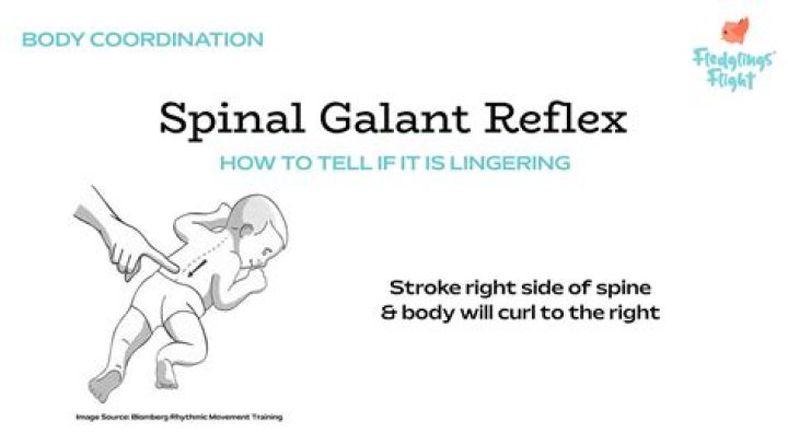 What is Spinal Galant reflex
