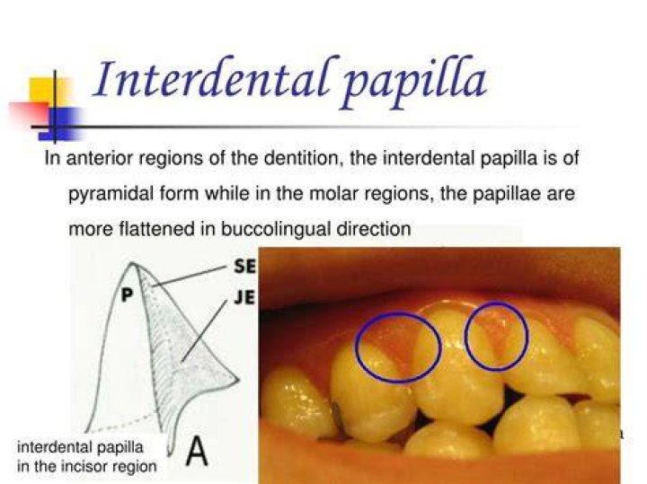 What is the interdental area