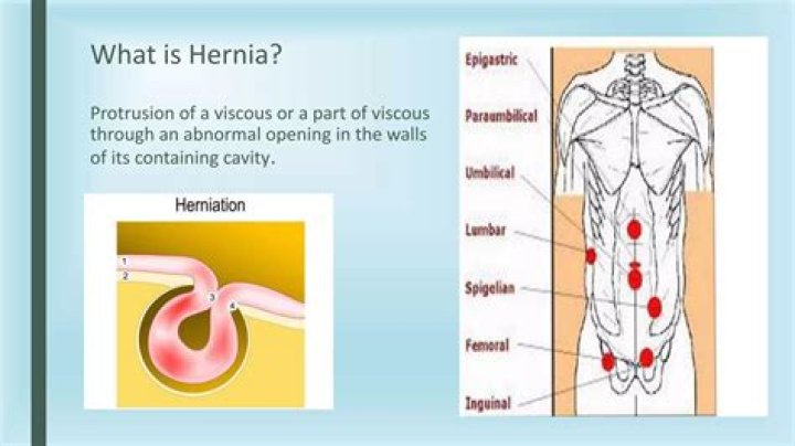 What is ventral the same as