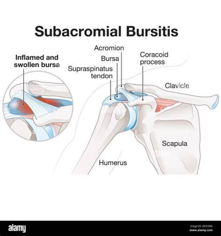 What joint is often associated with bursae