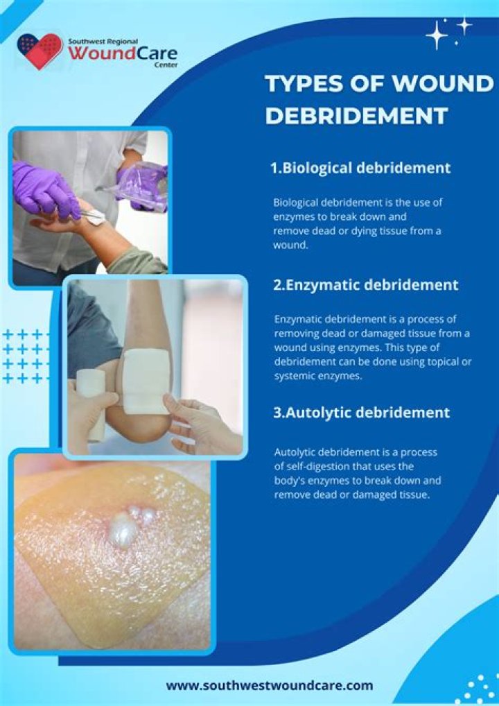 What methods can be used for debridement