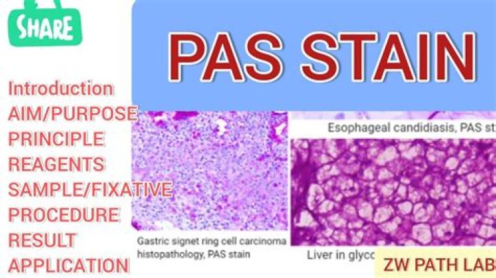 What stains positive for PAS
