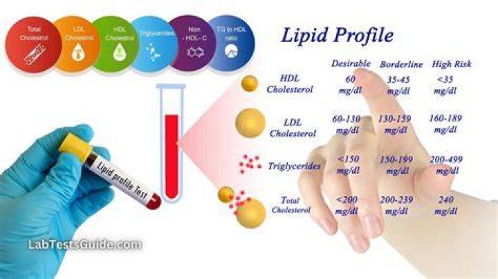 When should you check lipids
