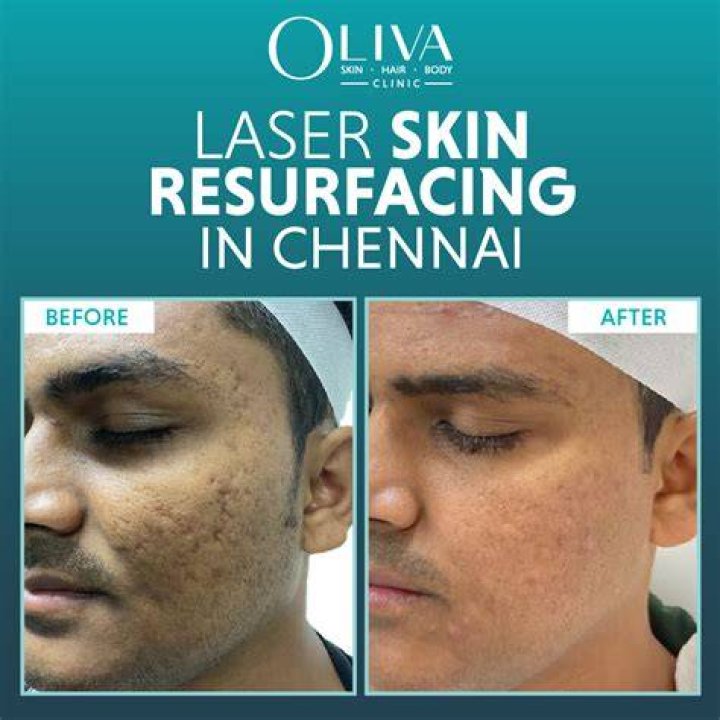 Where is rejuvenation based