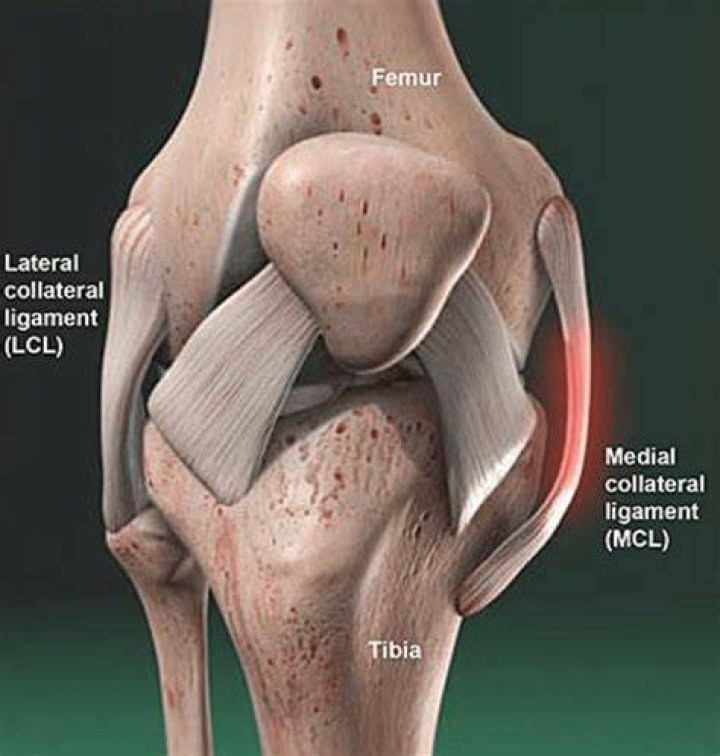 Which is stronger LCL or MCL