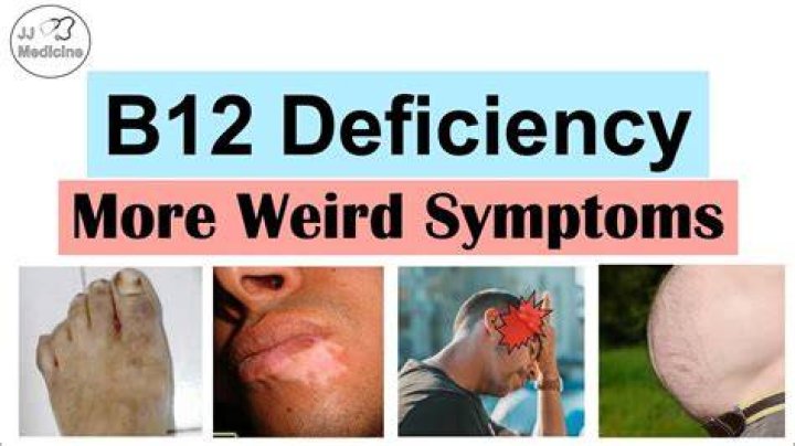 Which term means deficiency