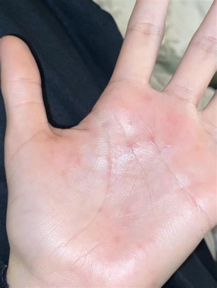 Why are my babys palms warm