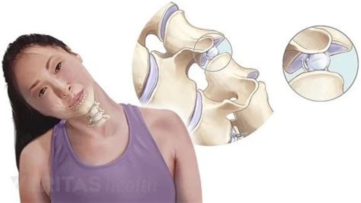 Why do my bones pop so much