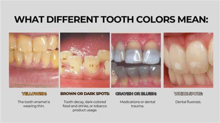 Why do rats teeth get orange