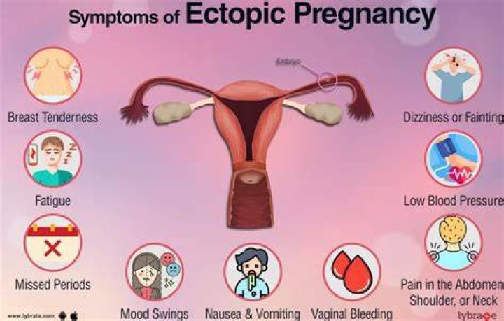 Why does ectopic focus occur