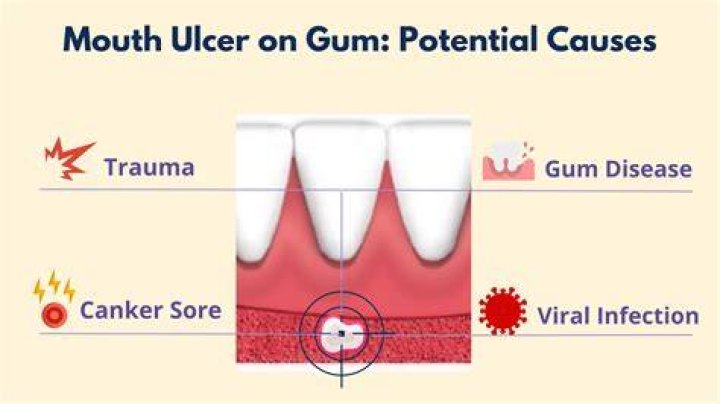 Why does gum turn into mush