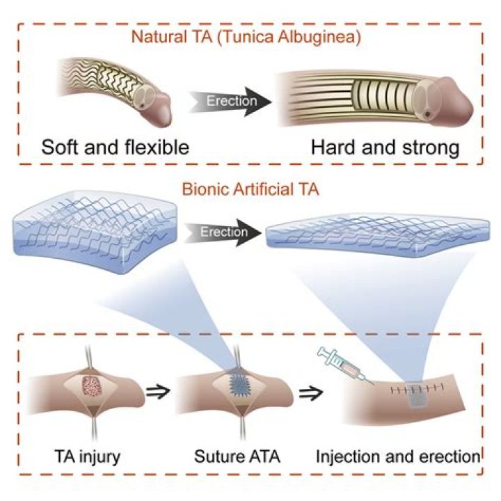 Why is the tunica albuginea