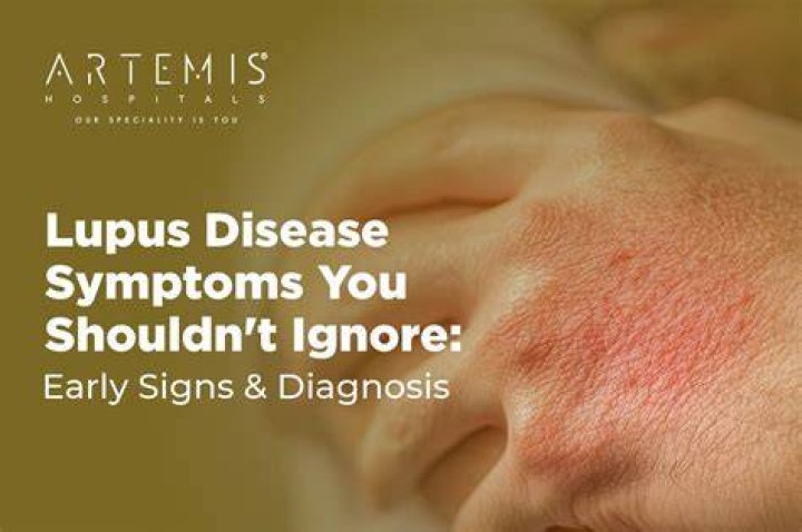 Would I know if I had lupus